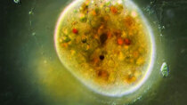 Journey to the Microcosmos - Episode 7 - Ophyroglena: The Tricky Transforming Ciliate