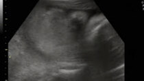 JesssFam - Episode 50 - 3D/4D Ultrasound at 29 Weeks Pregnant! (Part 1)