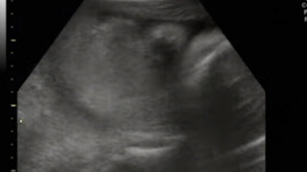 JesssFam - S01E50 - 3D/4D Ultrasound at 29 Weeks Pregnant! (Part 1)