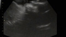 JesssFam - Episode 51 - 3D/4D Ultrasound at 29 Weeks Pregnant! (Part 2)