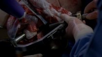 Grey's Anatomy - Episode 8 - Invest in Love