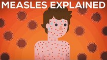 Kurzgesagt – In a Nutshell - Episode 2 - Measles Explained — Vaccinate or Not?