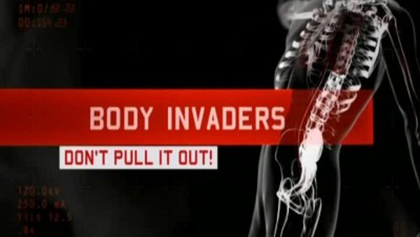 Body Invaders - S01E01 - Don't Pull it Out