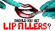 AsapSCIENCE - Episode 10 - The Strange Science of Lip Fillers