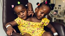 BBC Documentaries - Episode 164 - The Conjoined Twins: An Impossible Decision