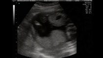 JesssFam - Episode 24 - 3D/4D Gender Ultrasound at 18 Weeks!