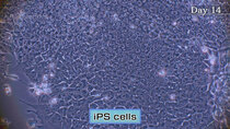 NHK World Prime - Episode 10 - 10 Years and Beyond: iPS Cells and Kyoto University's CiRA