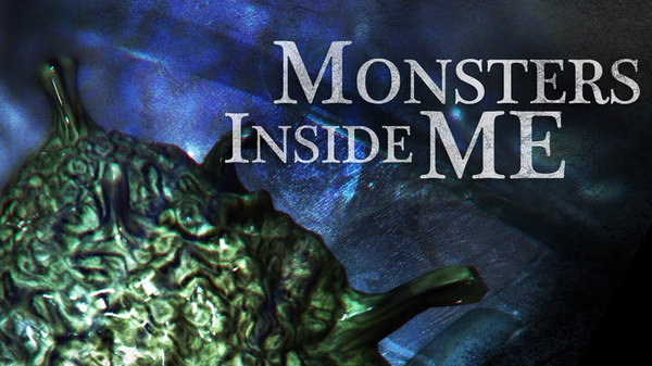 Monsters Inside Me: Extra Deadly - S01E02 - There's Something Living in My Knee?!