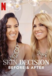 Skin Decision: Before and After