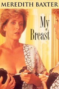 My Breast