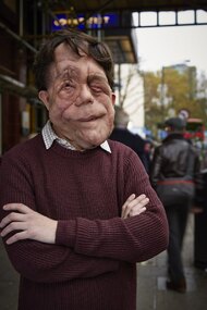 The Ugly Face of Disability Hate Crime