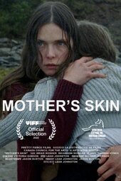 Mother's Skin