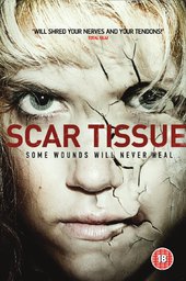 Scar Tissue