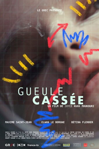 Gueule cassée