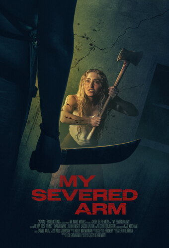 My Severed Arm